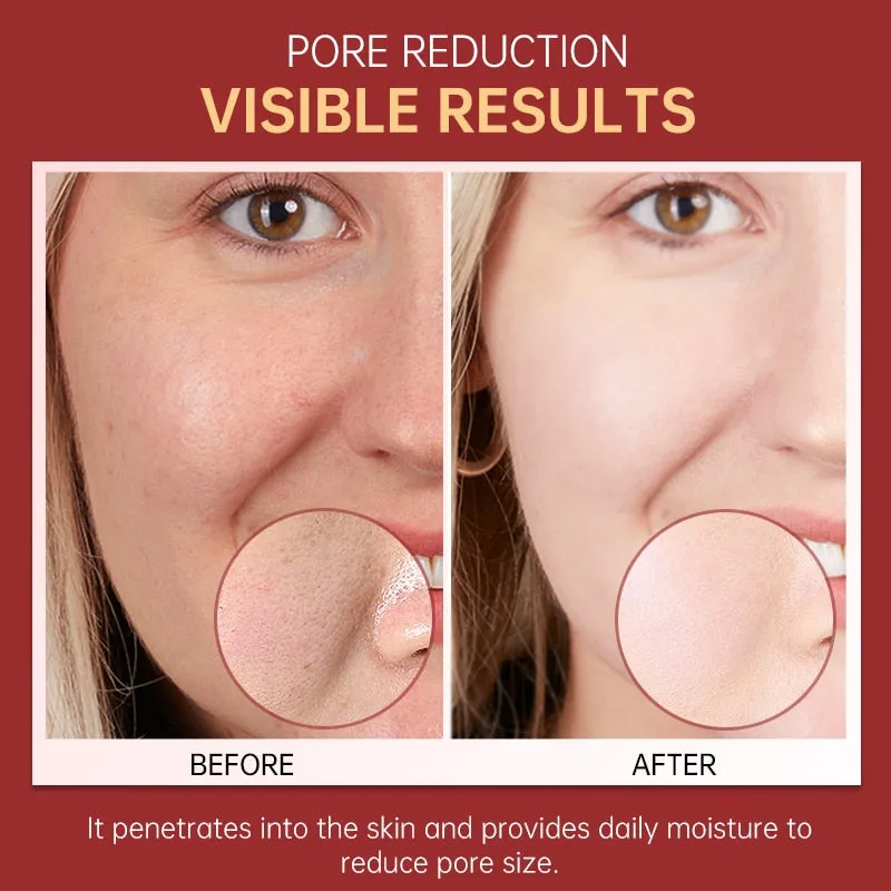 Dark Spots Whitening Skin Care Serum Niacinamide For Glowing Skin Hyaluronic Acid Collagen Pore Reduction Face Serum Care Beauty