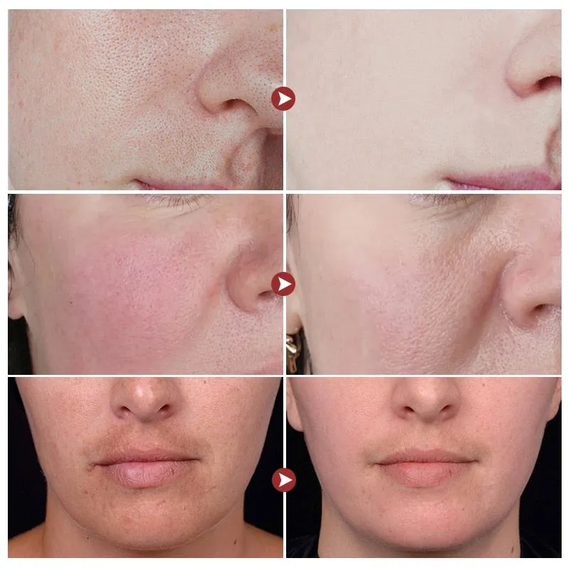 Dark Spots Whitening Skin Care Serum Niacinamide For Glowing Skin Hyaluronic Acid Collagen Pore Reduction Face Serum Care Beauty