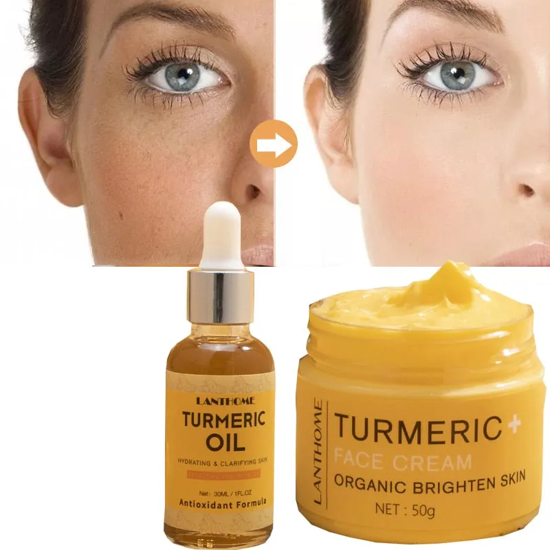 Organic Turmeric Acne Treatment Skin Lightening Cream and Oil
